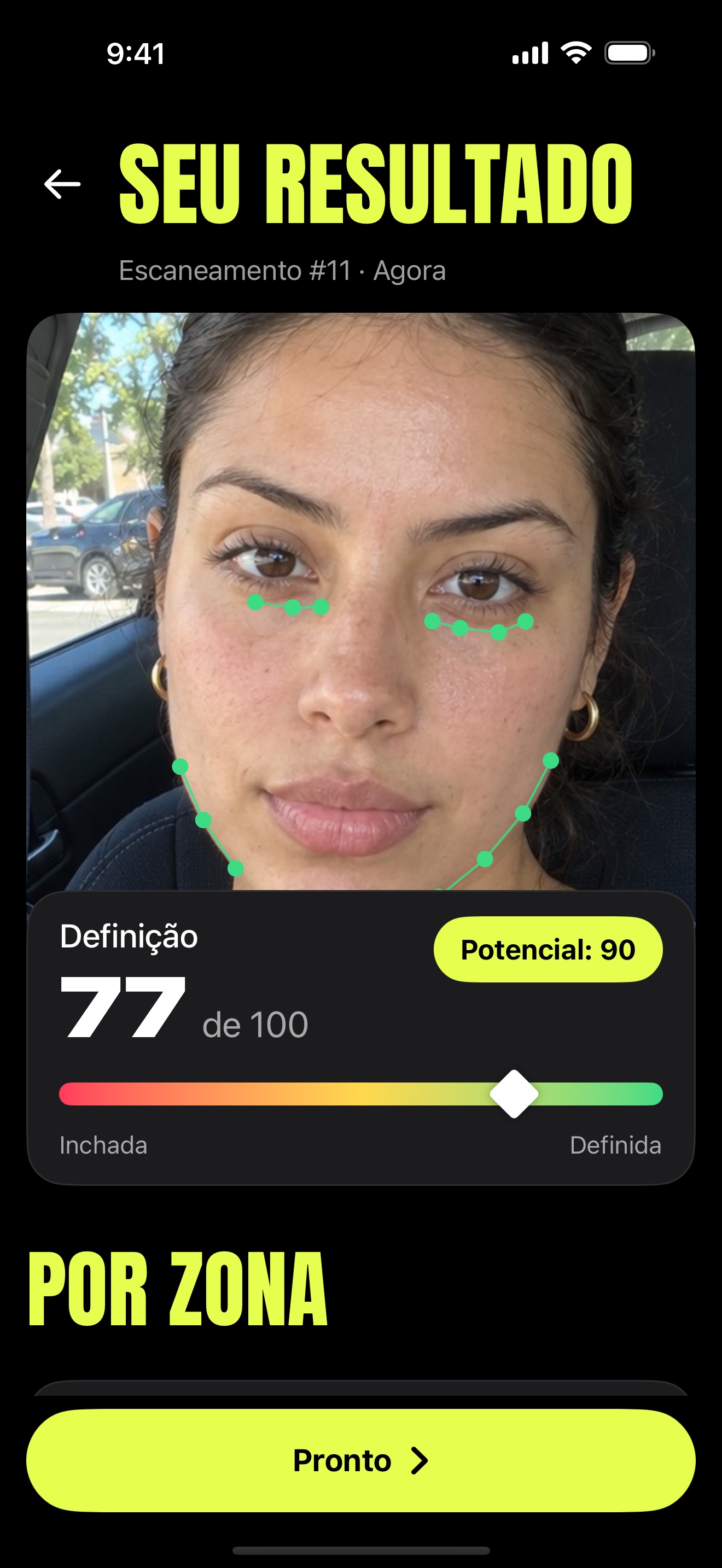 Tela Seu resultado: definição 71 de 100, potencial 87, com pontos de referência nos olhos e na mandíbula.